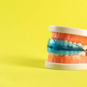 Solid Colored mouthguards